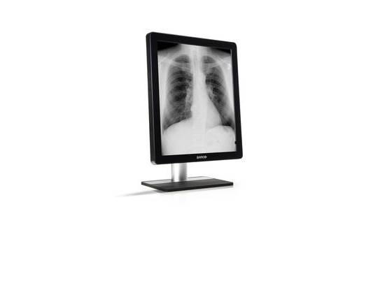 AlphaView MC30 21.3" Medical LCD Monitor - Grade B